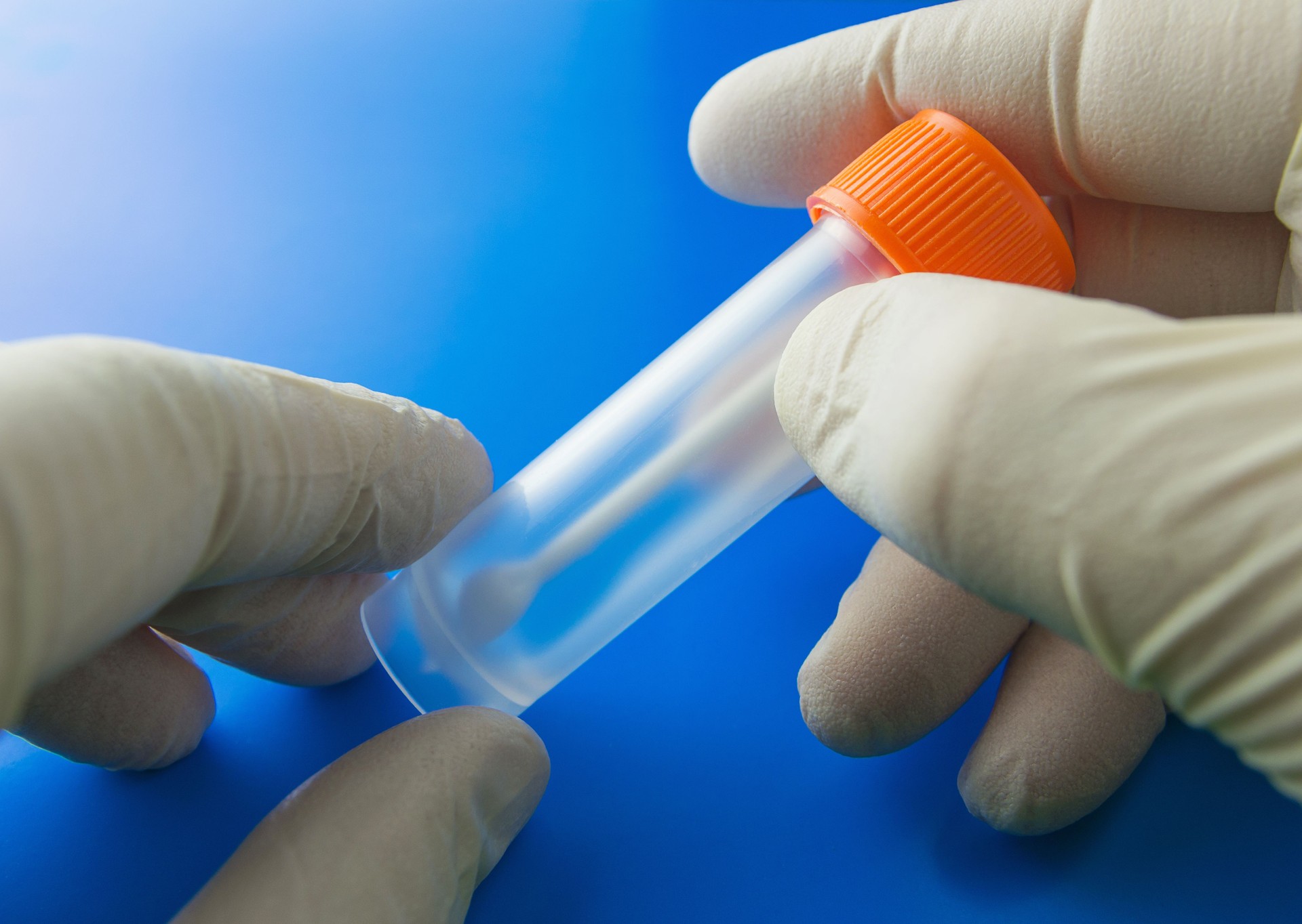 Doctor's hands with plastic container for analysis. Medical kit for the sampling of feces, coprology test.