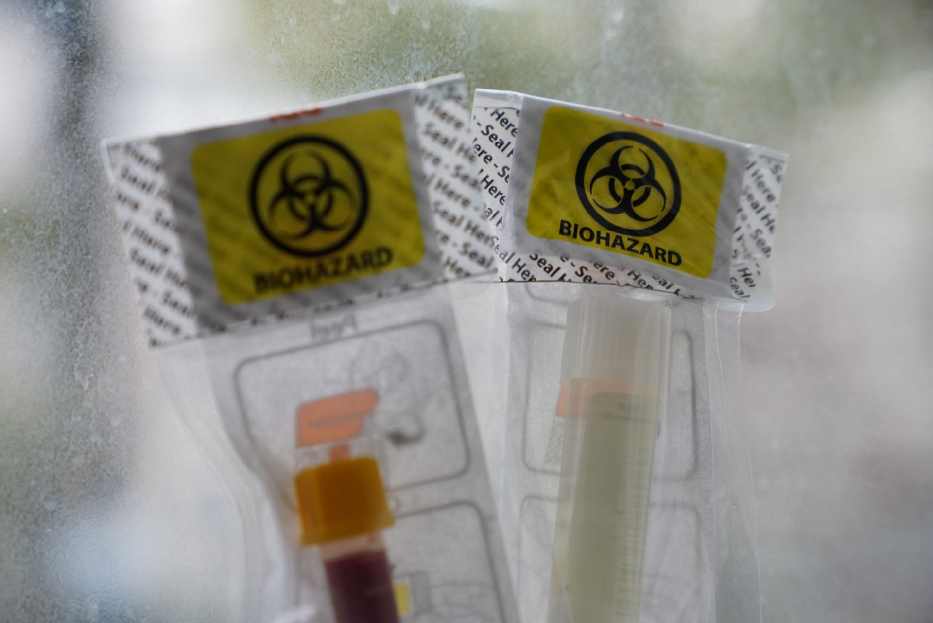 Urine Sample Test Kit, Biohazard Bag, Test Tubes, blood test